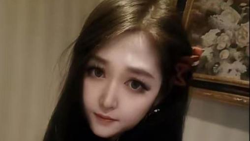 突发！“世纪婴儿”千千去世，年仅25岁，长得很漂亮，死因曝光令人惋惜
