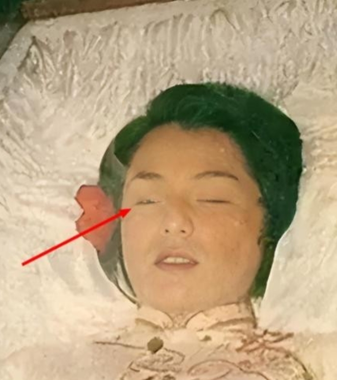 1985年，翁美玲服下安眠药后，又打开了煤气自杀，她去世时，脸上没有任何痛苦的痕
