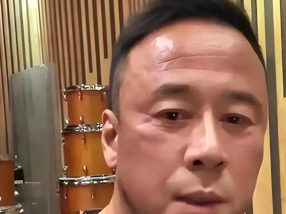 杨坤告不完，根本告不完。四川芬达倒下了，东北雪碧又上线了，重要的是人家又没模仿杨