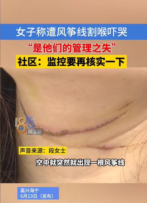 浙江嘉兴，一女子下班骑电动车回家路上，不慎被风筝线割了喉，所幸当时车速不快，保住