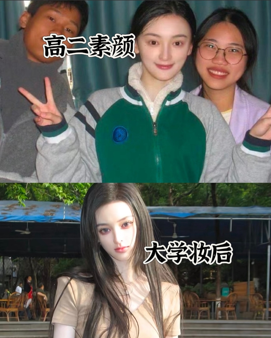 关于西安美院聋哑女孩宸玥，挖出了几点真相：

一、整过鼻子，把驼峰磨了，并不是网