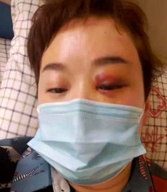 河南36岁妻子被丈夫家暴打断两根肋骨，没有提离婚，事后还朝老公撒娇，而老公也暖心