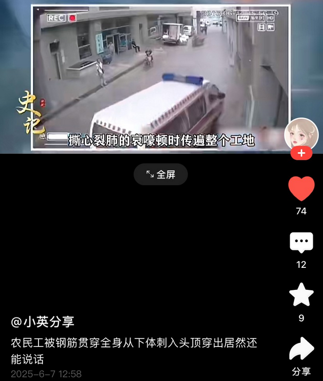 一名工地农民工，名叫张志。

为了10元加班费，不小心踩空，被1.5米的钢筋从下