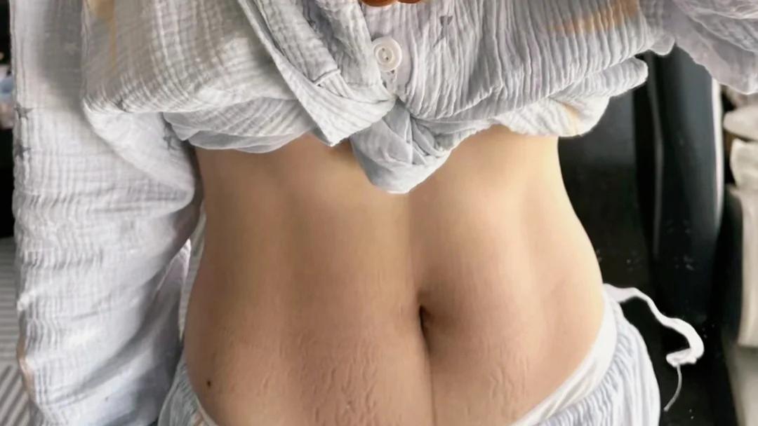 给妈妈最好的礼物：让妊娠纹温柔退场，开启美丽事业新机遇