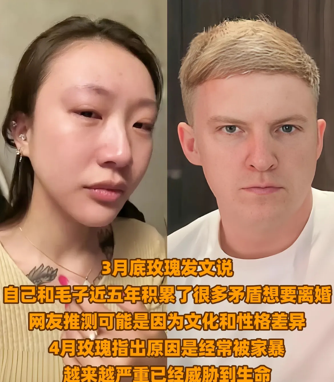 百万网红跨国婚姻遭家暴











天呐！拥有百万粉丝的网红，远嫁俄罗