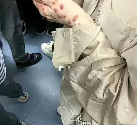 这手上张的太渗人了，给人无形的压力，无人敢靠近，地铁在挤，也不会挤她