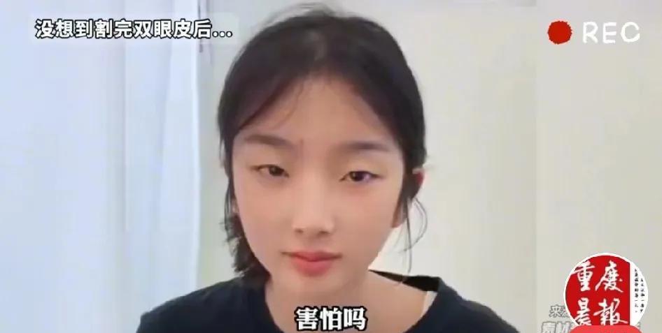 听劝！没事不要割双眼皮，这就是割之后的效果。没割之前是最特别的那个，割了之后已经