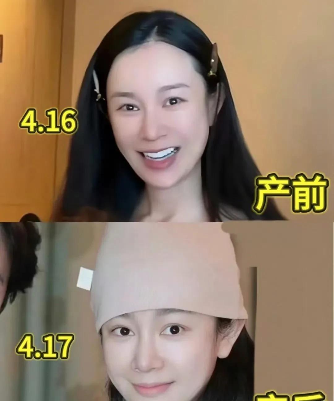 张檬给所有人上了一课
嫁个好男人有多重要
谁能想的到，36岁的张檬，产前产后居然