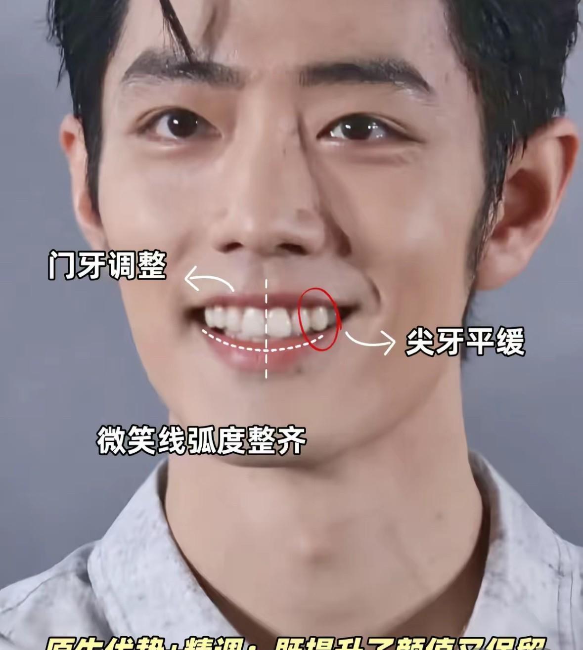 牙齿对容貌的影响有多大？
来看肖战就知道了
早期的兔牙已不在，调整后的牙齿更整齐