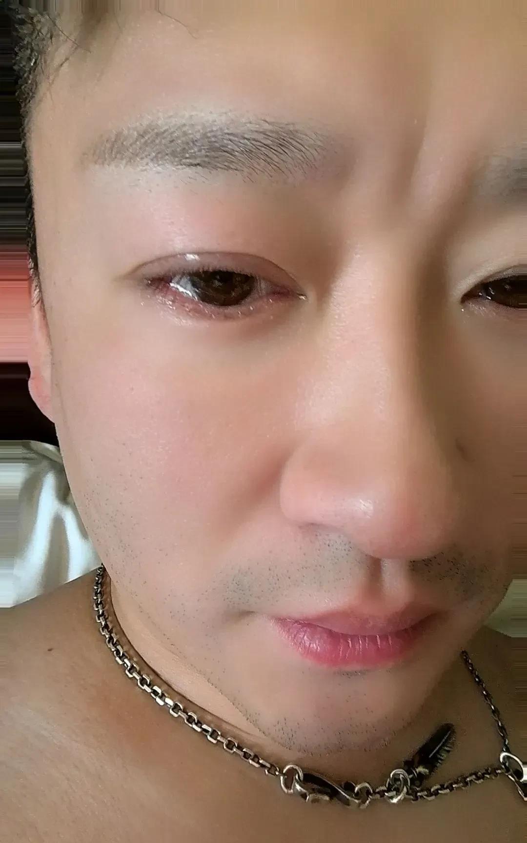 照片是曹云金的自拍照，并且类似于大头照那种。
曹云金两眼含泪，可能是刚睡醒，也有