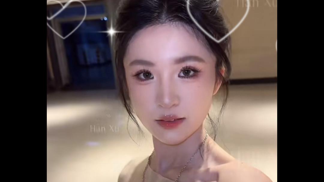 7mm扇形双眼皮术后效果如何？韩旭案例：打造灵动扇形大眼！