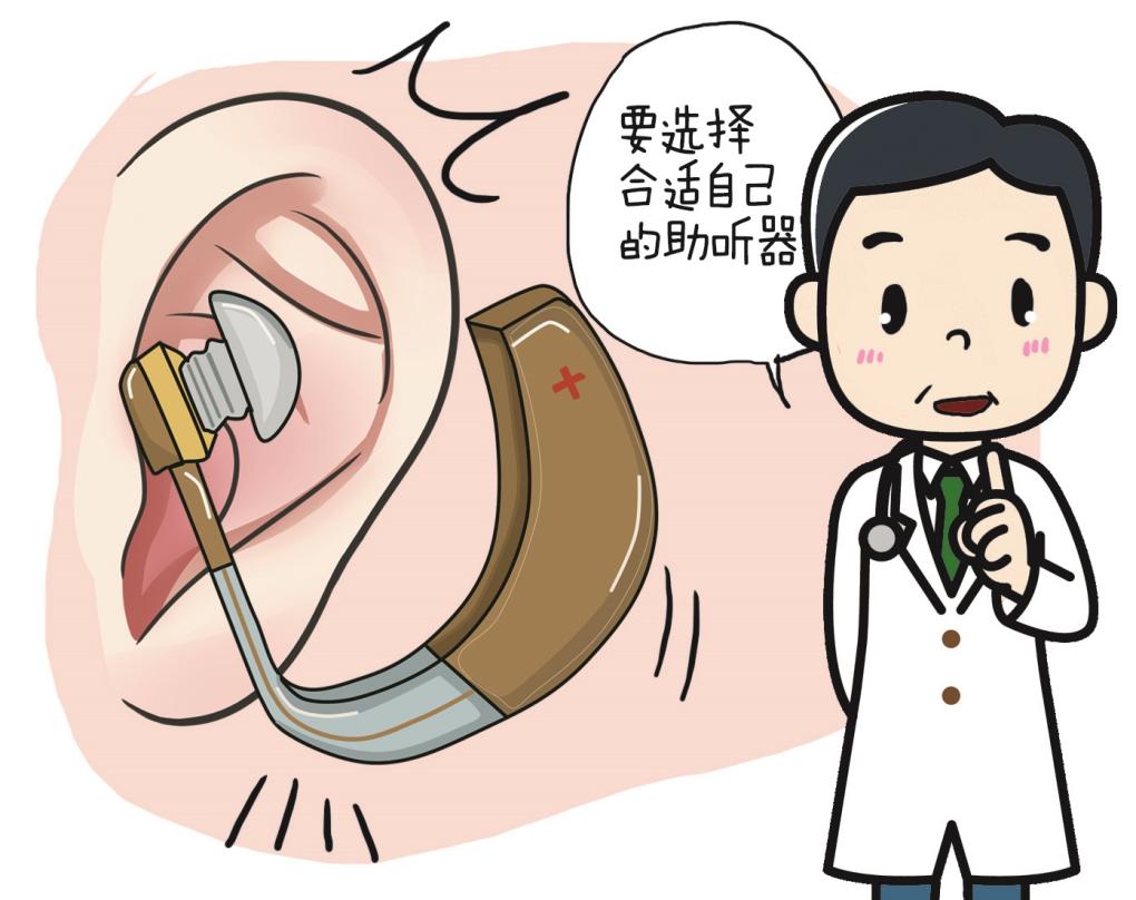 怎样购买助听器?需要先做耳部检查吗? 怎样购买助听器?需要先做耳部检查吗?