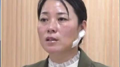 河南女警休假途中徒手夺刀制凶 脸部受伤缝30多针