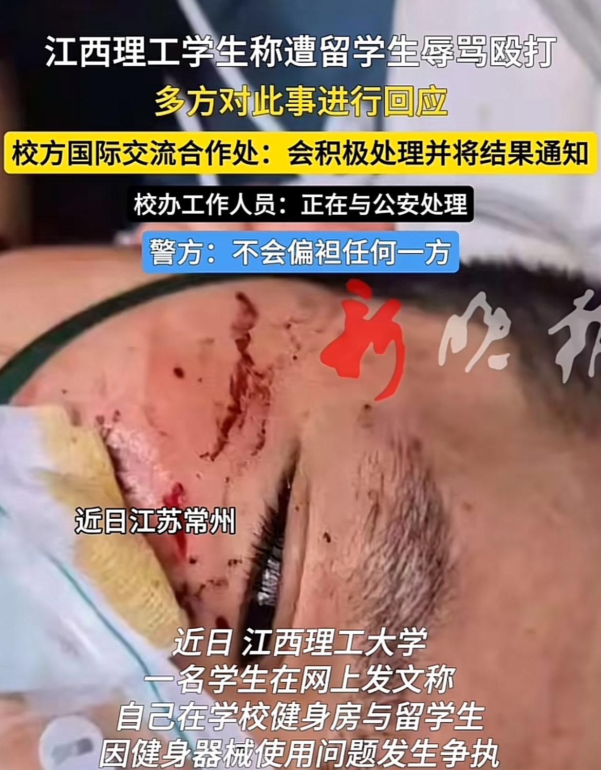 江西理工一大学生遭留学生殴打，围观男生的表现才是最让人失望的！
据被打的大学生说