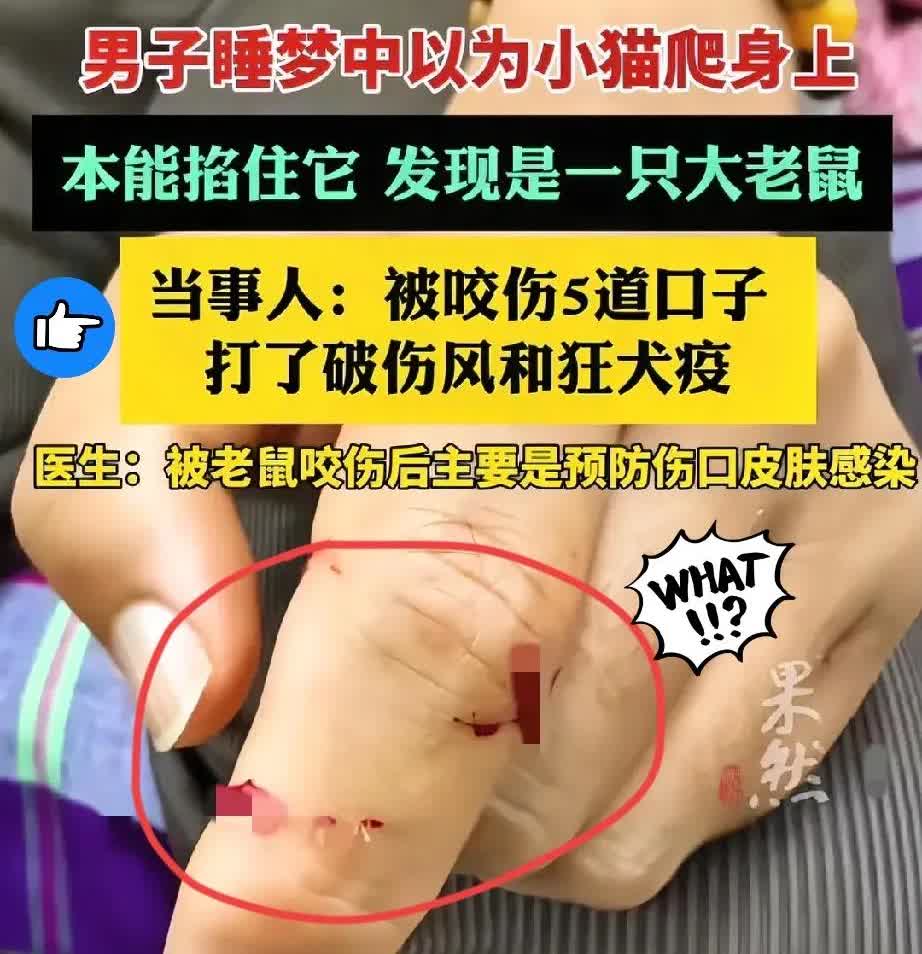 “太悲剧了！
”江苏无锡，男子睡觉时，
感觉手上有东西在爬，迷迷糊糊以为是自