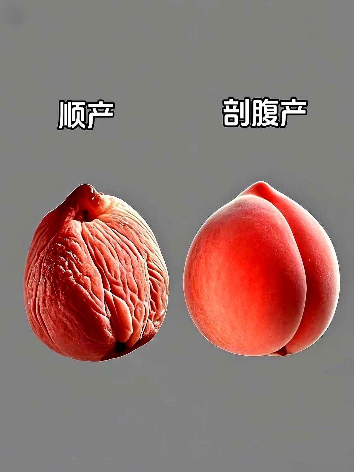终于知道医生为啥都劝能顺就顺！
你觉得是剖腹好还是顺的好呢？
姐妹们听句实话，真