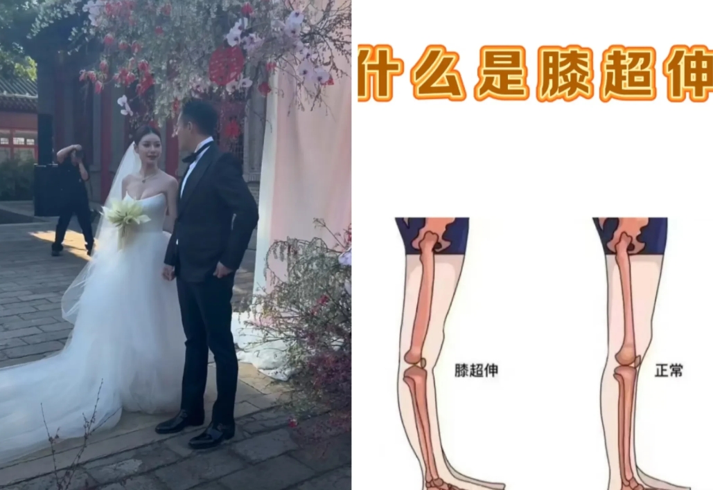 刷了一整天马筱梅和小汪总的大婚视频
我发现一个问题
不是关于婚礼，而是关于人
小