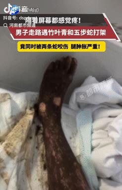 电视剧都不敢这么演！8月20日，安徽，一男子傍晚散步时，偶遇竹叶青和五步蛇打架，