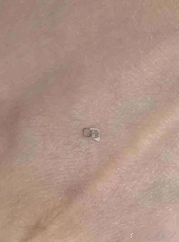江苏，一名女子在家看电视时，突然感觉想咳嗽，就用手捂住嘴咳嗽了几下，结果感觉有异