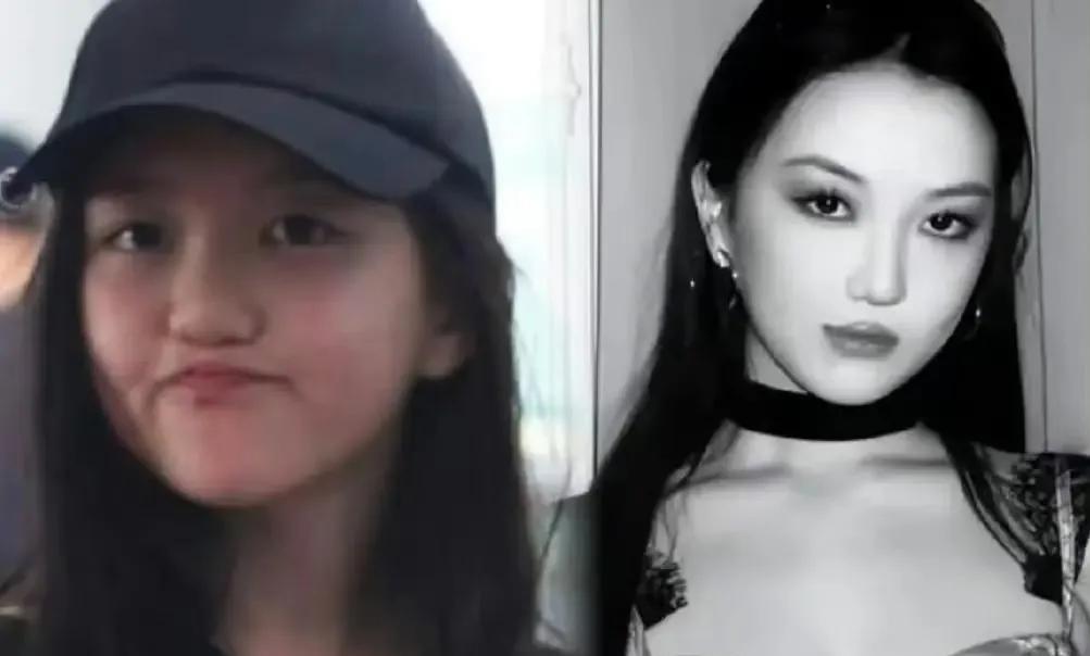 李嫣兔唇痕迹消失不见，王菲“钞能力”送她别样人生。