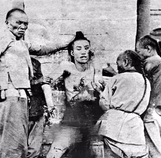 1907年，反清义士徐锡麟，被处决前留下的一张罕见老照片
徐锡麟，1873年12