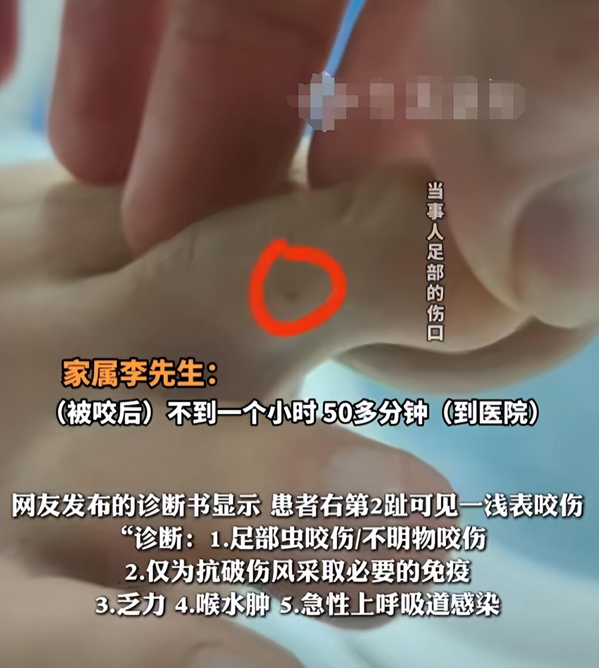 女游客被蛇咬伤身亡后续：“罪魁祸首”浮出水面，本来可以救活的