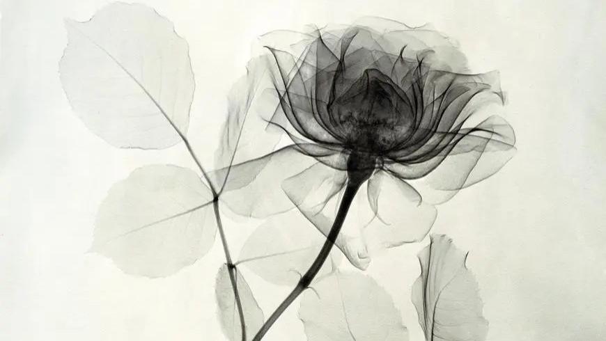 当医生转行摄影师，大胆尝试用X光来拍照，太厉害了！