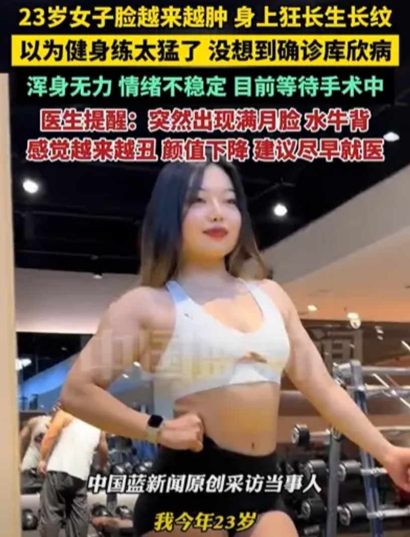 太悲催了！广东，23岁女生喜欢撸铁，不料，撸着撸着，不仅脸越来越肿，身上更是狂长