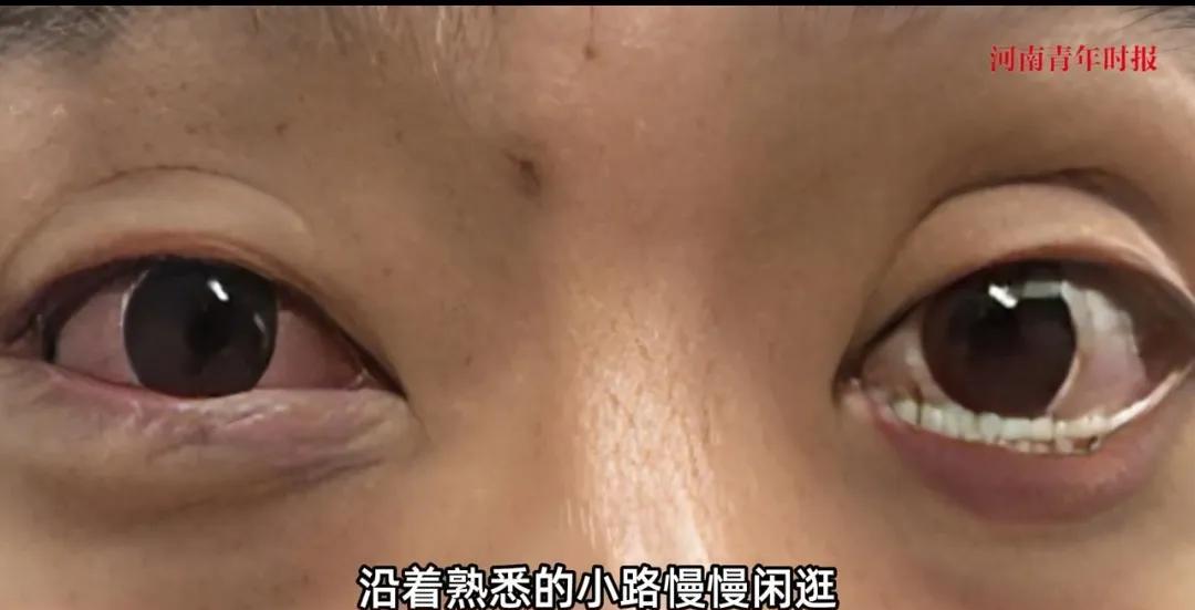 什么不玩，偏要玩五步蛇，被喷了一脸毒液！38岁男子周大哥爱户外也喜欢玩蛇。前几天
