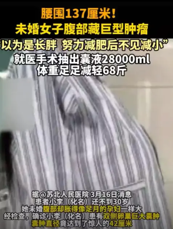 “活久见！”3月16日，江苏扬州，一位20多岁的女子被“大肚腩”困扰了3年，最终