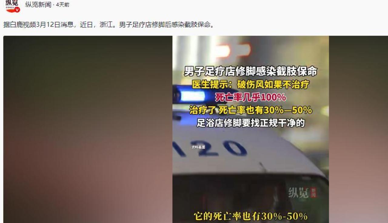 “什么？截肢！这么小的一个伤口让我截肢？”一男子在医院愤怒的对着医生吼道。
3月