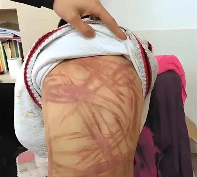 上海，离异男子对儿子要求严格，不仅因琐事将儿子打骨折，还在大冬天将儿子泡在冷水里