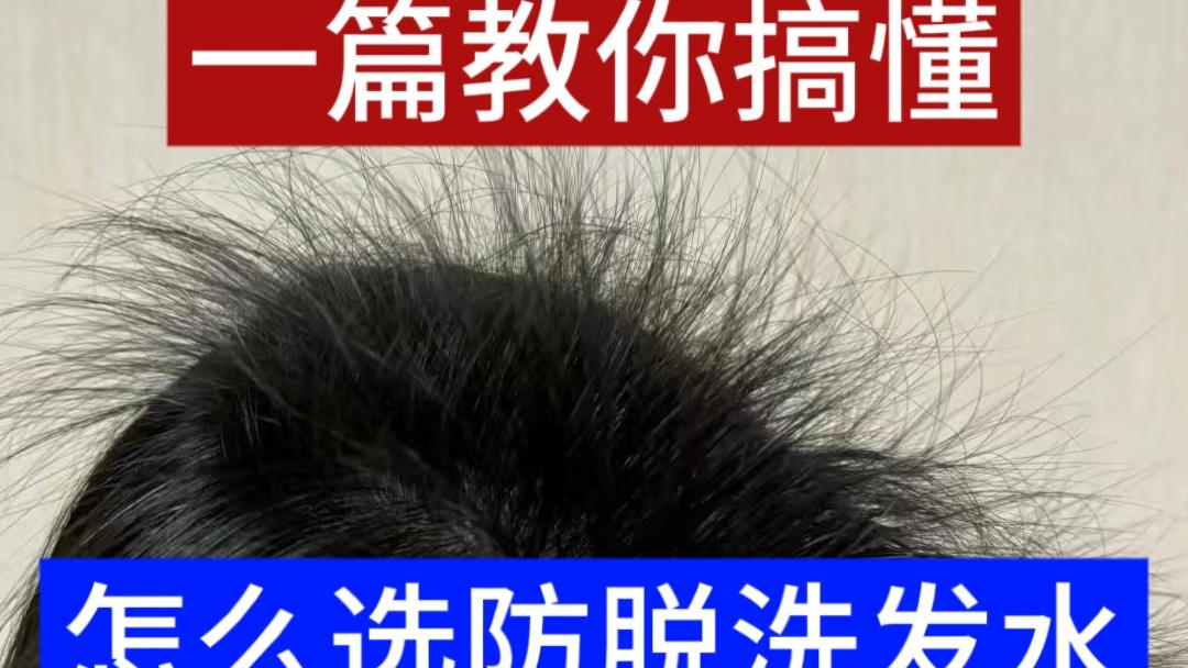 真人实验防脱洗发水什么牌子最有效果？脱发避雷指南，十大专业级防脱育发品牌种草