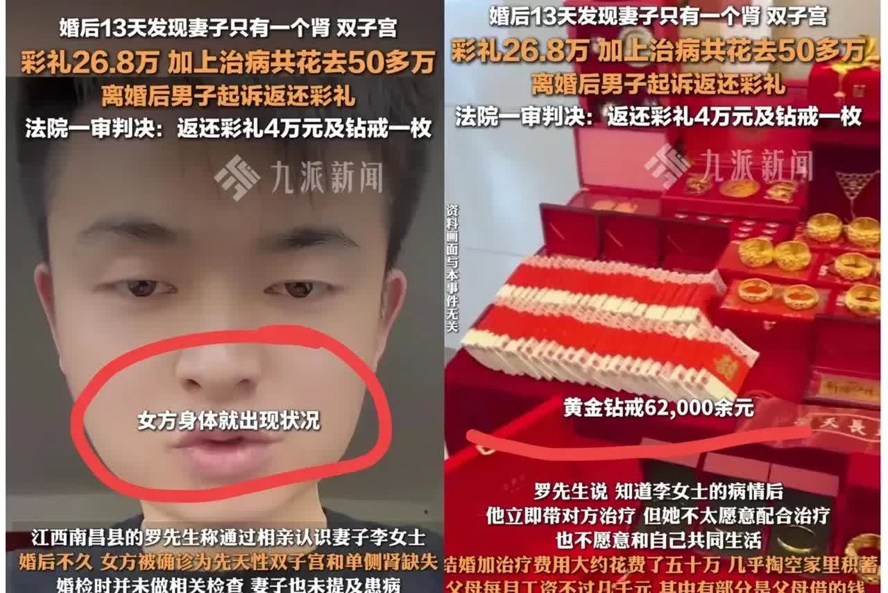 我问我老公，关于婚后13天发现妻子只有一个肾，如果是你会怎么办？   他点了一支