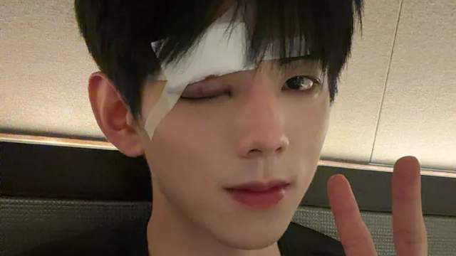 短剧演员被真打热搜卖惨，对比成龙吴京浑身是伤，差距一目了然