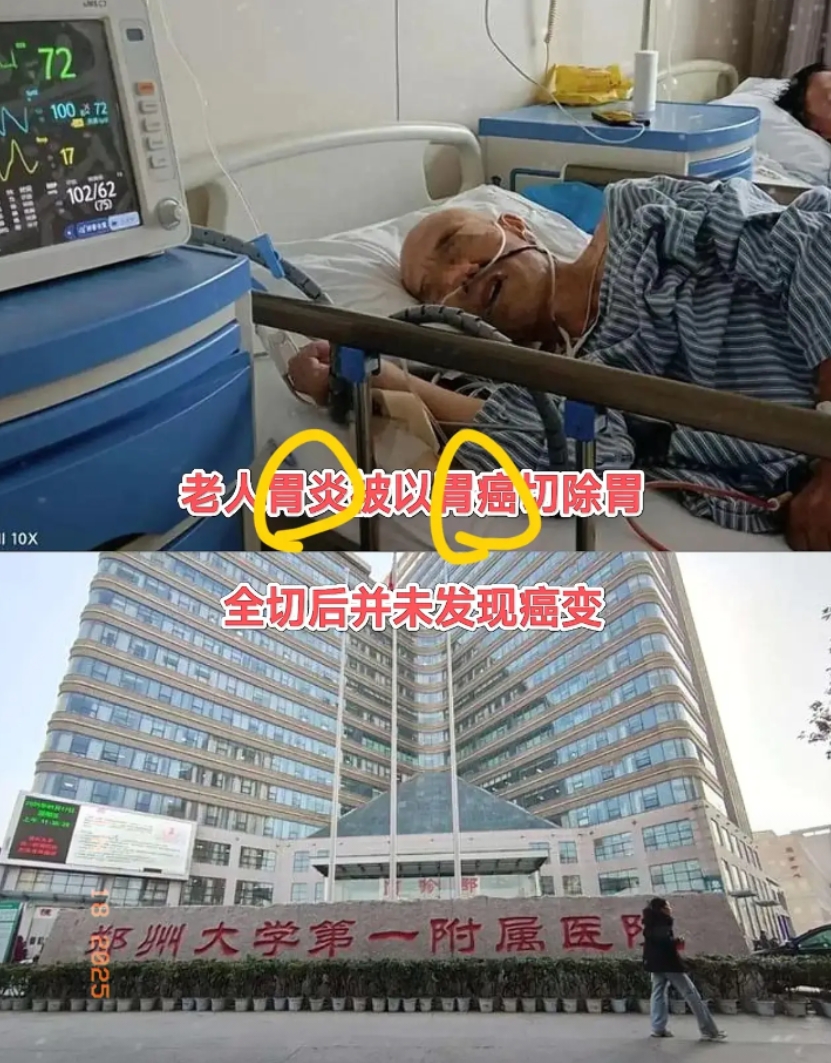 难道又是一起刘翔峰事件？
惊了！郑大第一附属医院又爆大瓜！
老人只是胃炎入院，最