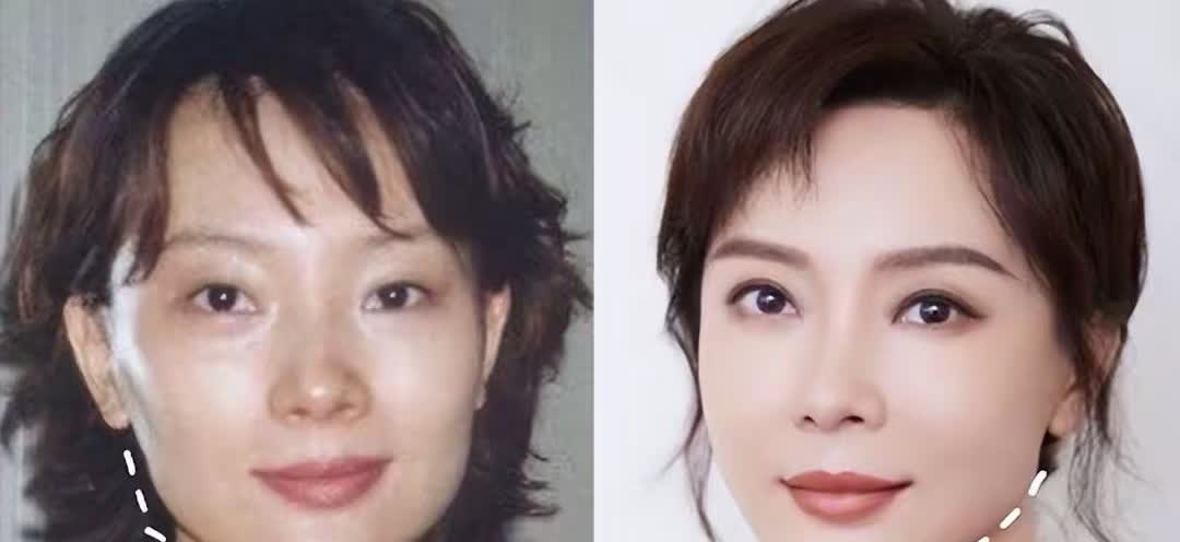 长得“歪瓜裂枣”，整得“美若天仙”，这位女星最终靠脸逆天改命
