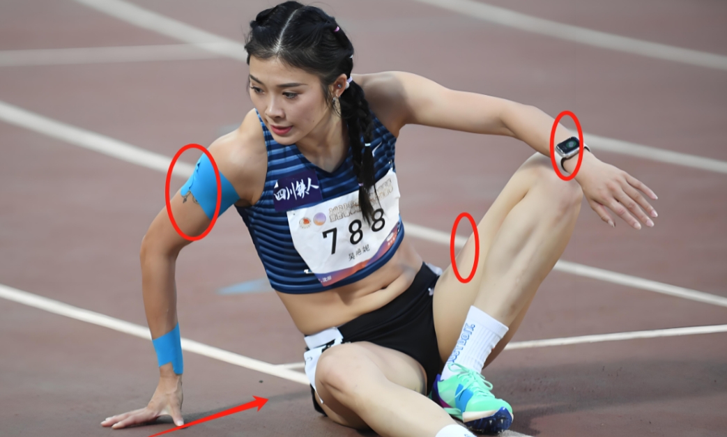 关于吴艳妮，
我特地去查了一下，
不查不知道，
一查吓一跳，

原来她带着伤还在
