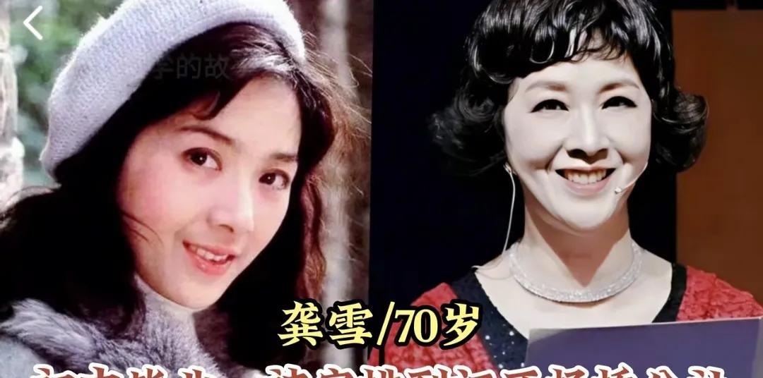 上山下乡的13位明星，葛优养猪，陈佩斯去沙漠，石小满农场干7年
第1位:龚雪
第
