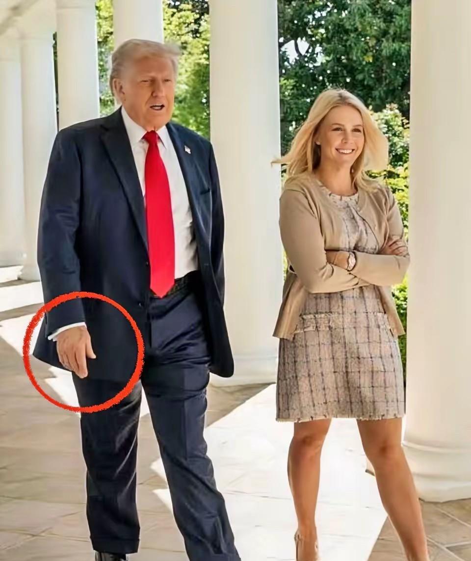 一片哗然！79岁的特朗普被确诊确实有病。针对特朗普手部大块淤青问题，白宫此前一直