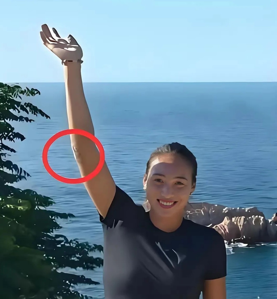 郑钦文已经回来了，手术后正在积极恢复！昔日的Queen Wen又要横扫女子网坛了