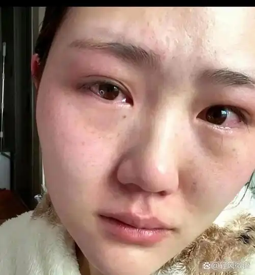 “要么洗掉，要么退婚退彩礼！”女子洗完澡后，背后痒得难受，便让婆婆帮忙挠挠