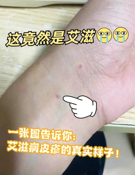 艾滋病患者隐瞒病情致伴侣感染，通常算有意伤害，会被认定为故意伤害罪。
 
根据相