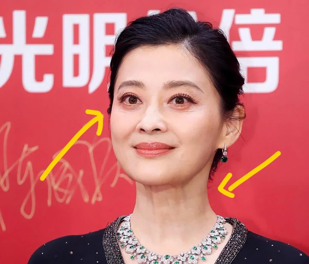 50岁的梅婷
有个很大的问题
难道你们没有发现吗？那就是她的脸上一点医美的痕