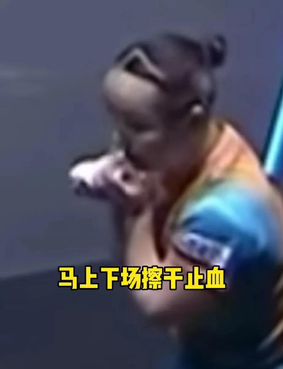 有人说:这种才是真的需要暂停处理，不像某些人～
这才是真的需要医疗暂停[赞]张本
