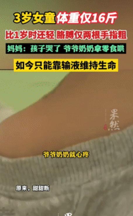 3月13日，河南一3岁女孩体重仅16斤，胳膊只有“两指粗”！不料，医生查出的真相