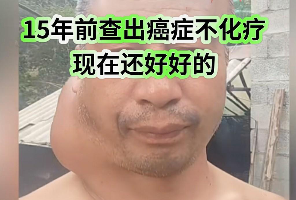 深圳一位大哥说，他15年前查出癌症，自从发现病之后，他坚持不化疗，不焦躁，总是保