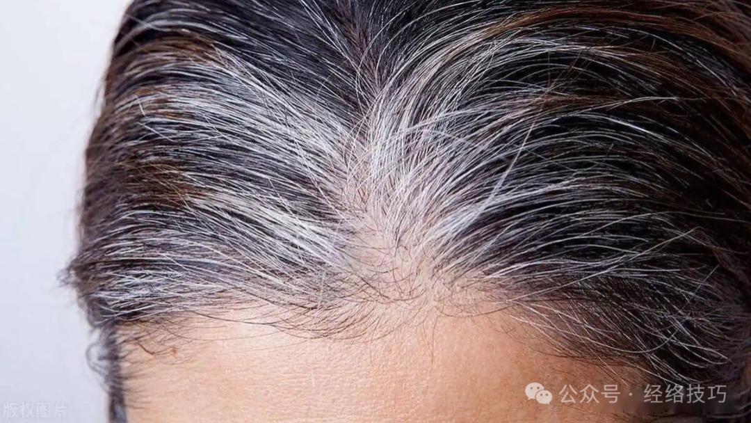头发早早变白，可能是这里出了毛病！多按按这几个地方，助你的头发白的慢一点！