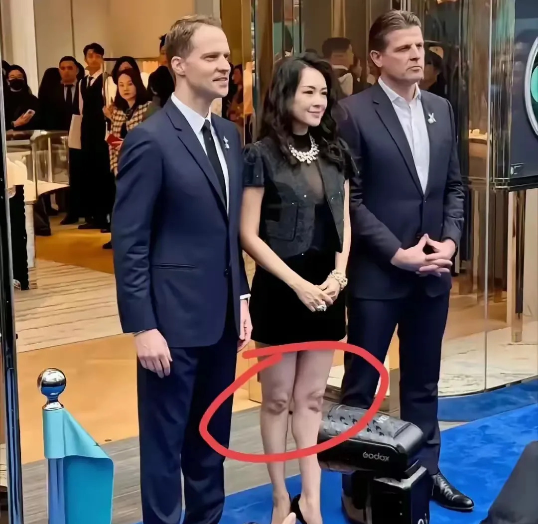章子怡拍戏膝盖受伤了











天呐！章子怡拍戏竟然把膝盖弄伤了，看