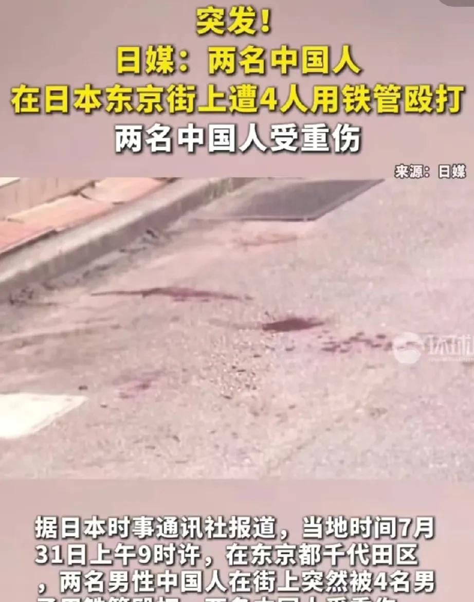 中国人在日本又被无故攻击了，两个中国人在东京街上，突然被4个人用铁管殴打至重伤，